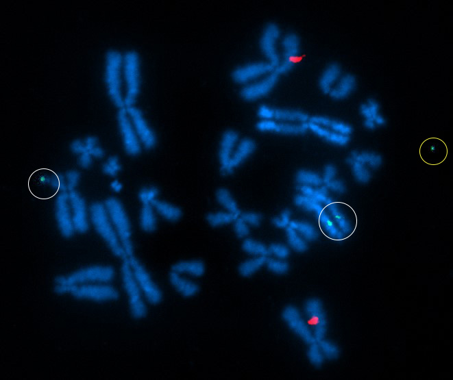 dGH in-Site assay in edited CHO cells featuring custom transgene probe (green) and control probe (red). One insertion event is on an ecDNA fragment (yellow circle). The larger of the other two insertions (white circles) represents an inverted duplication.